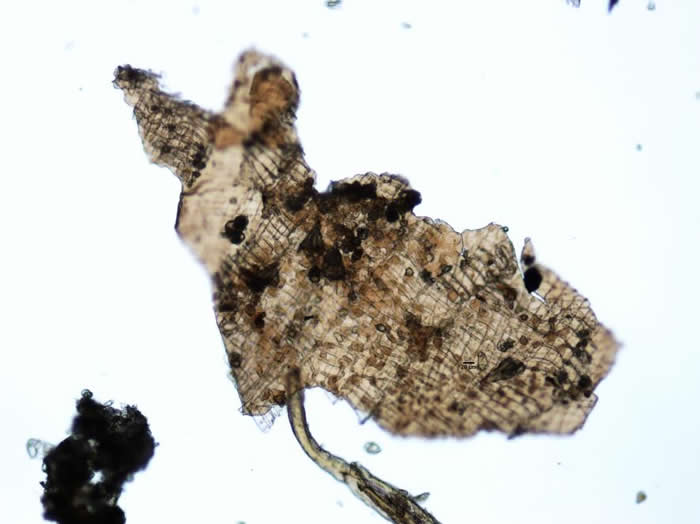 研究者在冰人的胃部内容物中发现的一小片未消化植物组织。 PHOTOGRAPH COURTESY INSTITUTE FOR MUMMY STUDIES, EUR